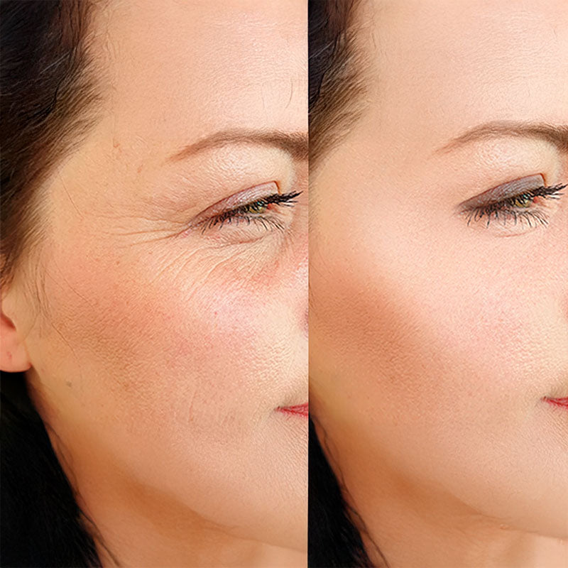 Transformação impressionante da Renata, depois de 5 semanas usando o colágeno com Blend Origins8.