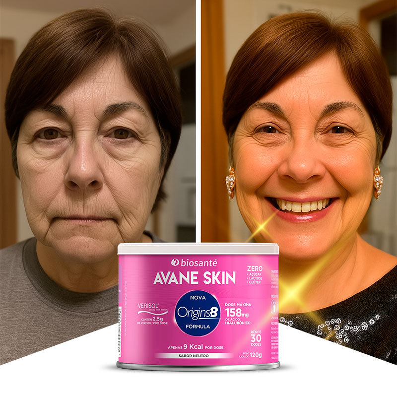 Transformação impressionante da Renata, depois de 5 semanas usando o colágeno com Blend Origins8.