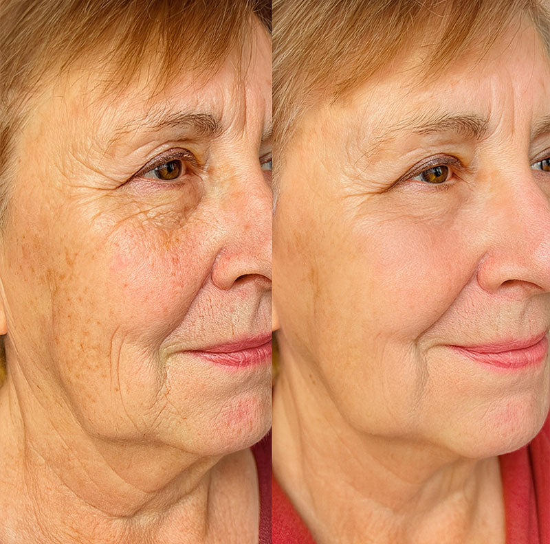 Transformação impressionante da Renata, depois de 5 semanas usando o colágeno com Blend Origins8.